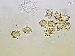Chlamydospores, organes de reproduction végétative.