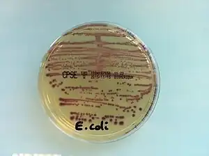 Culture d'Escherichia coli sur CPS E à partir d'une urine.