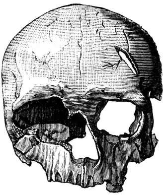 Crâne d'un Homme de Cro-Magnon (féminin).