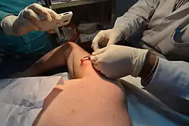 Chez une personne à Lima au Pérou.