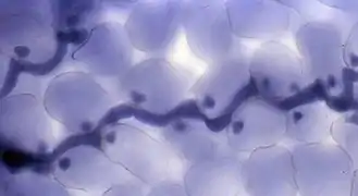 Seconde étape (végétative) du cycle court de H. parasitica : Formation d'hyphes par Hyaloperonospora parasitica (ici toujours dans une feuille d’Arabidopsis thaliana colorée au bleu de trypan marquant en bleu foncé le cytoplasme de H. parasitica). La longue structure est l'hyphe. Les petites sphères sont les haustoria.