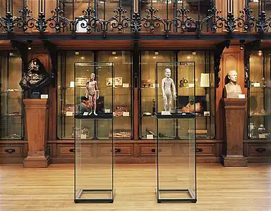 Vue latérale des écorchés.