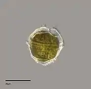 Peridinium willei (Peridiniaceae).