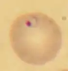 Plasmodium falciparum (Alveolata, Apicomplexa), parasite responsable du paludisme (stade en anneau dans une hématie).