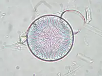 Stephanodiscus neoastraea.