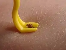 Tique dans une pince.