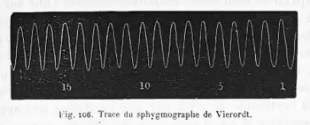 Fig. 106. Tracé isochrone du sphygmographe de Vierordt n'indiquant que le nombre de pulsations.