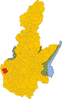 Localisation de Chiari