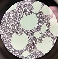 Description de l'image 1000x Magnification of Gram Stain of Staphylococcus xylosus Under Brightfield Microscopy.jpg.