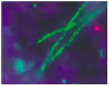 Description de l'image Acidobacterium.jpg.