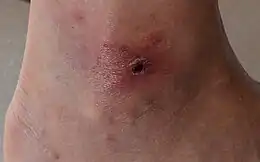 Description de cette image, également commentée ci-après