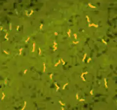 Description de l'image Borrelia duttoni.jpg.