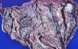 Description de cette image, également commentée ci-après