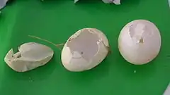 Description de l'image Brontchite oûs3.jpg.