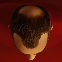 Description de cette image, également commentée ci-après