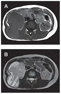 Comparaison côte à côte de deux coupes IRM.
