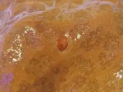 La plaque madréporitique bien visible d'une Choriaster granulatus.