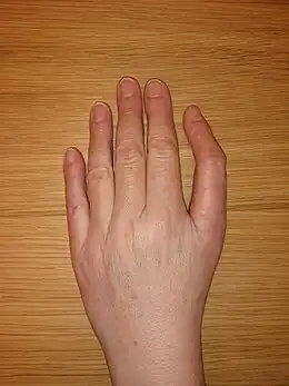 Description de l'image Dreigliedriger Daumen.jpg.