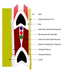 Schéma d'une coupe verticale d'un espace intercostal montrant de haut en bas, la côte supérieure, le paquet vasculo-nerveux avec dans l'ordre la veine, l'artère et le nerf, puis à distance la côte inférieure, de part et d'autre du paquet un muscle intercostal, l'un à l'extérieur, l'autre à l'intérieur