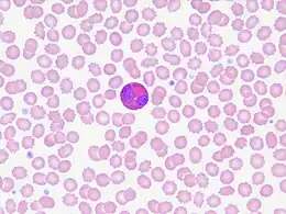 Description de l'image Eosinophils in peripheral blood.jpg.