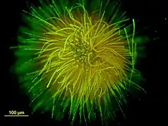 Colonie en forme de boule formée par une des espèces de Gloeotrichia (vue au microscope, avec coloration).