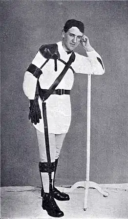 Photographie en noir et blanc d'un homme debout muni d'un appareillage orthopédique complexe, prenant la jambe droite.