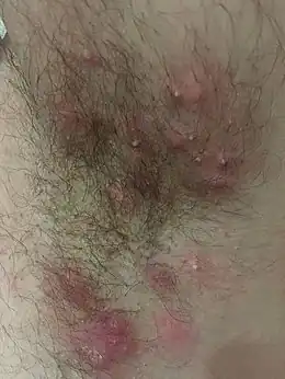 Description de cette image, également commentée ci-après