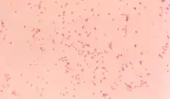 Description de l'image Moraxella Catarrhalis.png.