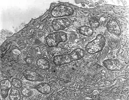 Description de l'image Orientia tsutsugamushi.JPG.