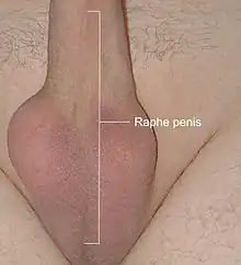 Photographie d'un autre pénis humain en érection.