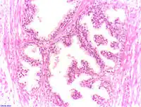 Tissus prostatiques normaux