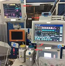 Scope et respirateur d'anesthésie