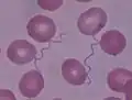 Deux spirochètes, dans un frottis sanguin, au milieu de globules rouges