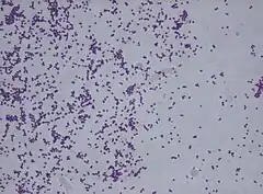 Description de l'image Staphylococcus saprophyticus.jpg.