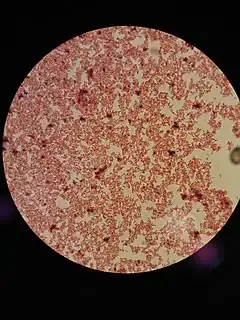 Description de l'image The Gram Staining - Bacteria Gram Negative.JPG.