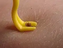 Tique dans une pince.