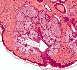Multiples glandes sébacées s'abouchant à un follicule pileux.