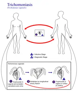 Description de l'image Trichomoniasis 01.png.