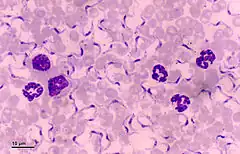 Description de l'image Trypanosoma (248 09) Trypanosoma equiperdum.jpg.