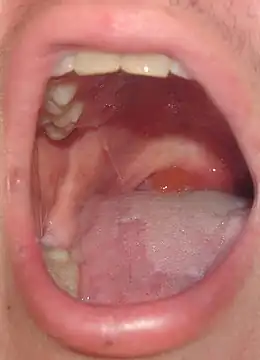 Description de cette image, également commentée ci-après