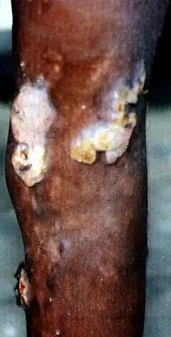 Description de l'image Yaws, PNG.jpg.