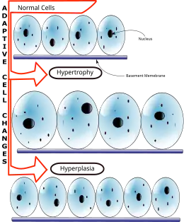 Description de l'image Hyperplasia vs Hypertrophy.svg.
