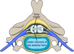 Description de l'image Polio spinal diagram-en.svg.